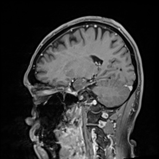 Click on the Serie image to view the images of VILLANUEVA, WILLIAM A.